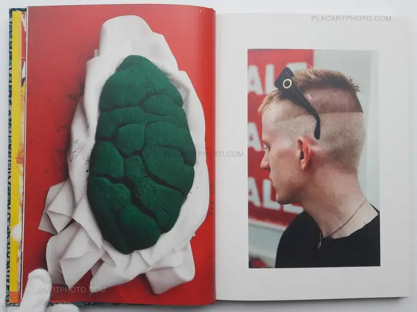 Lorenzo Vitturi – Dalston Anatomy (SIGNED)