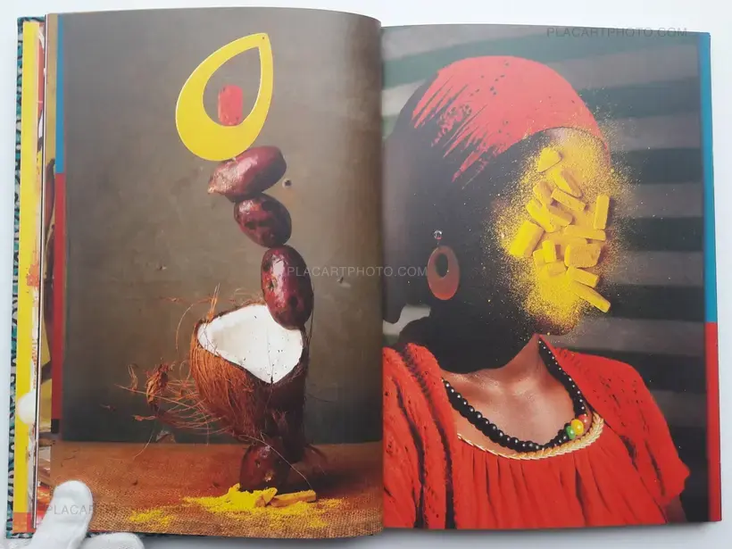 Lorenzo Vitturi – Dalston Anatomy (SIGNED)