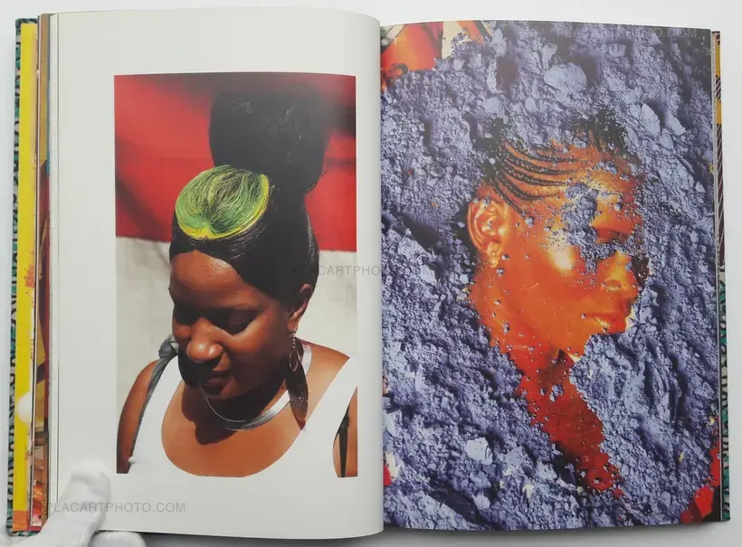 Lorenzo Vitturi – Dalston Anatomy (SIGNED)