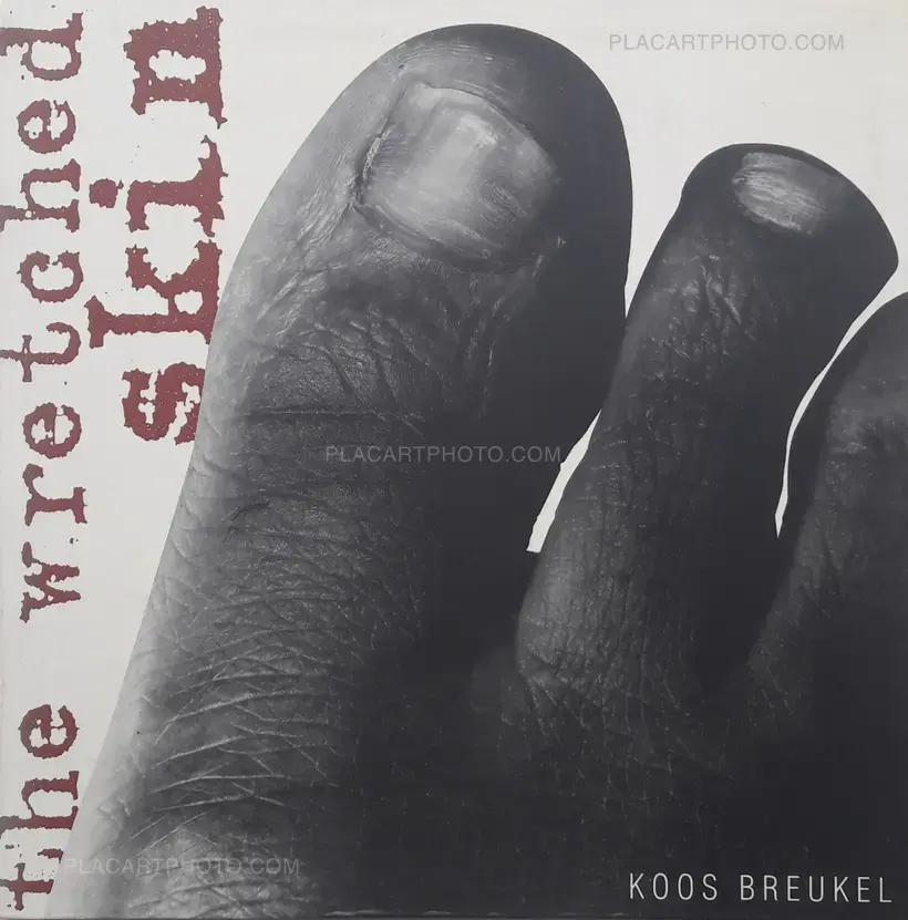 Koos Breukel – The Wretched skin (DEDICATED)