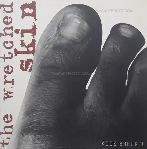 Koos Breukel – The Wretched skin (DEDICATED)