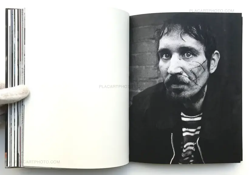 Magnus Cederlund – Skin Close
