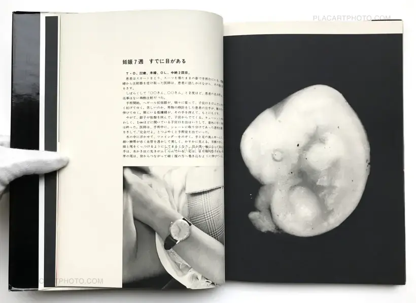 Kazuo Kenmochi – PHOTOGRAPHIC DOCUMENT THE TINIEST LIFE