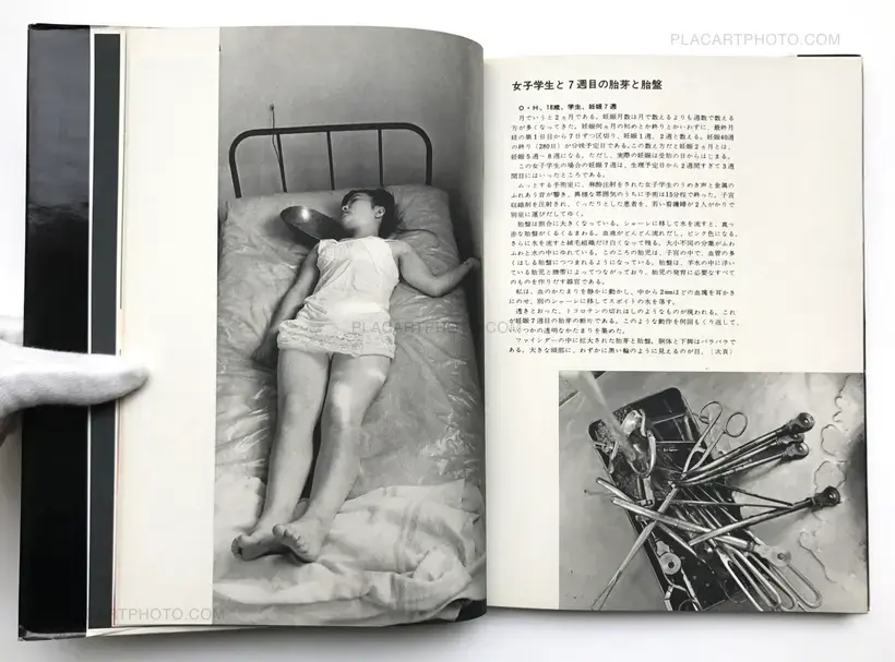 Kazuo Kenmochi – PHOTOGRAPHIC DOCUMENT THE TINIEST LIFE