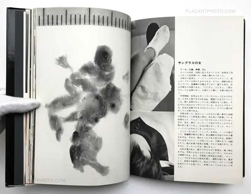 Kazuo Kenmochi – PHOTOGRAPHIC DOCUMENT THE TINIEST LIFE