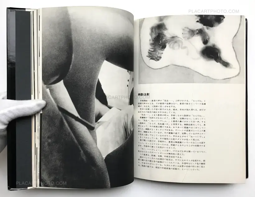 Kazuo Kenmochi – PHOTOGRAPHIC DOCUMENT THE TINIEST LIFE