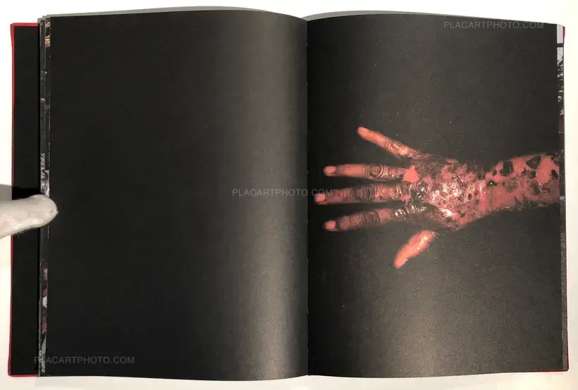 Yael Martinez – La Casa Que Sangra (Signed)