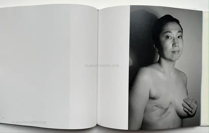 Hideka Tonomura – SHINING WOMAN #cancerbeauty
