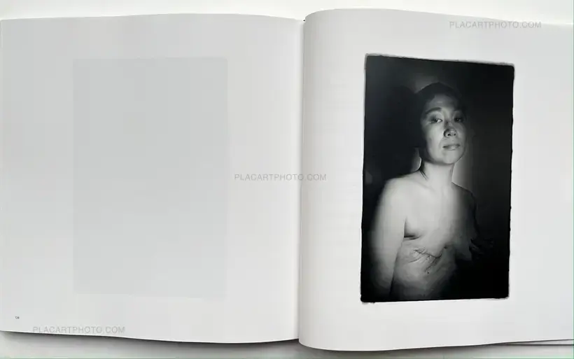 Hideka Tonomura – SHINING WOMAN #cancerbeauty