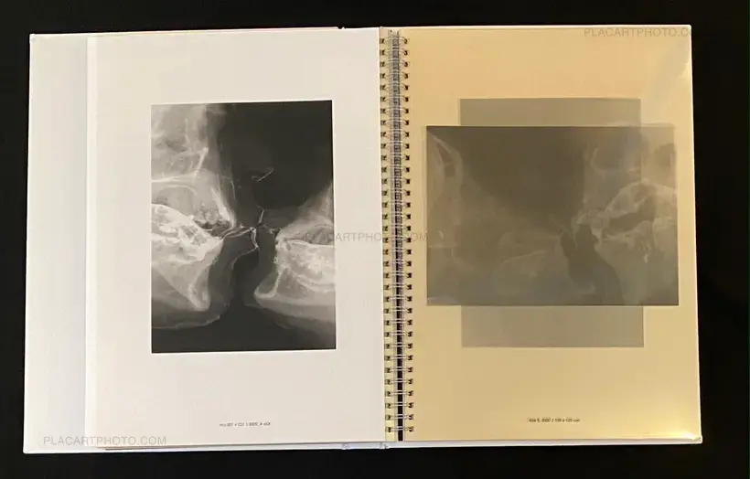 Wim Delvoye – seXrays