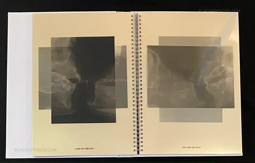 Wim Delvoye – seXrays