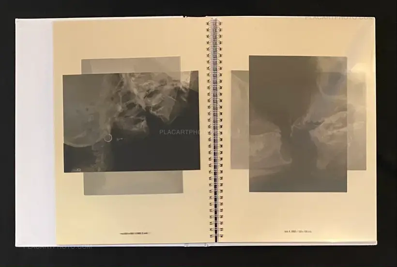 Wim Delvoye – seXrays
