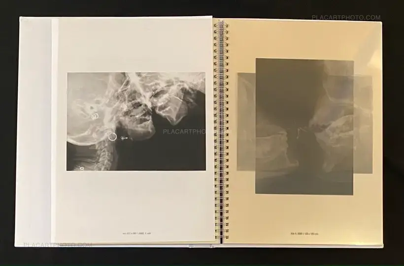 Wim Delvoye – seXrays