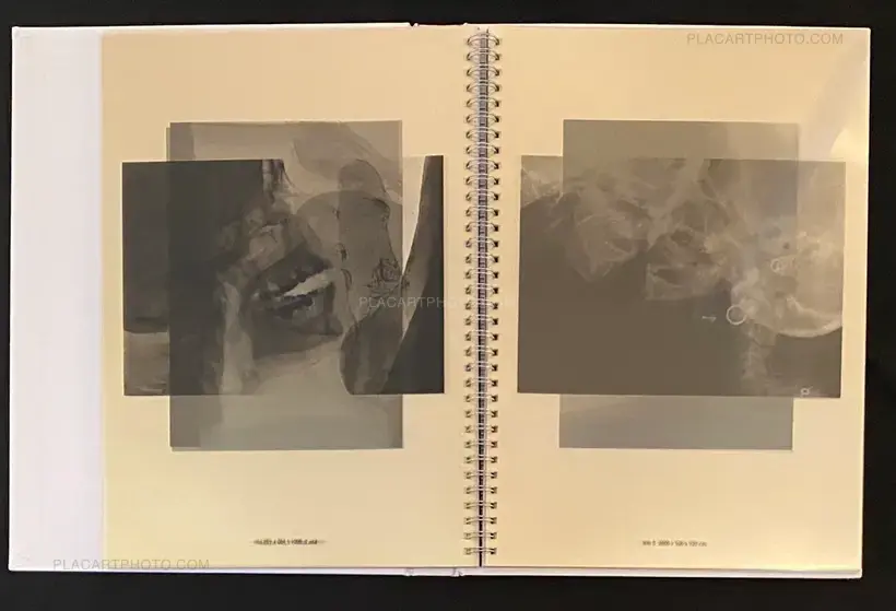 Wim Delvoye – seXrays