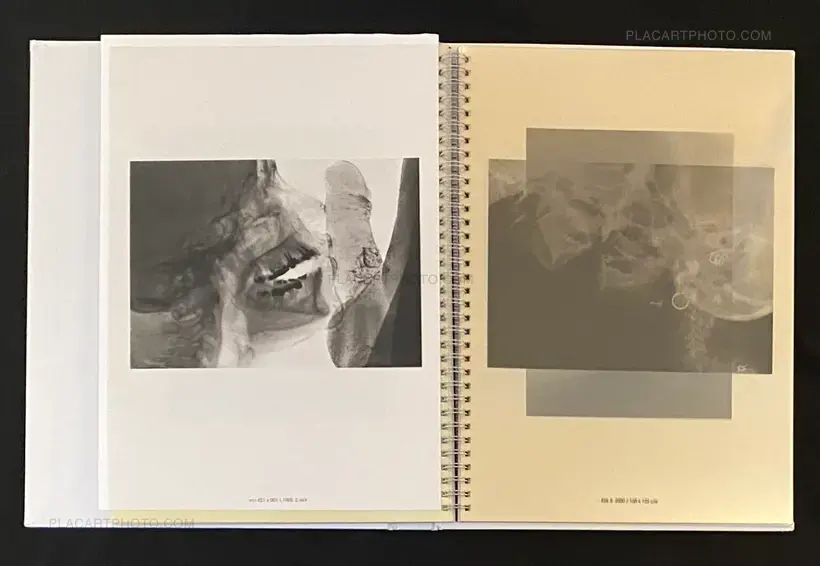 Wim Delvoye – seXrays