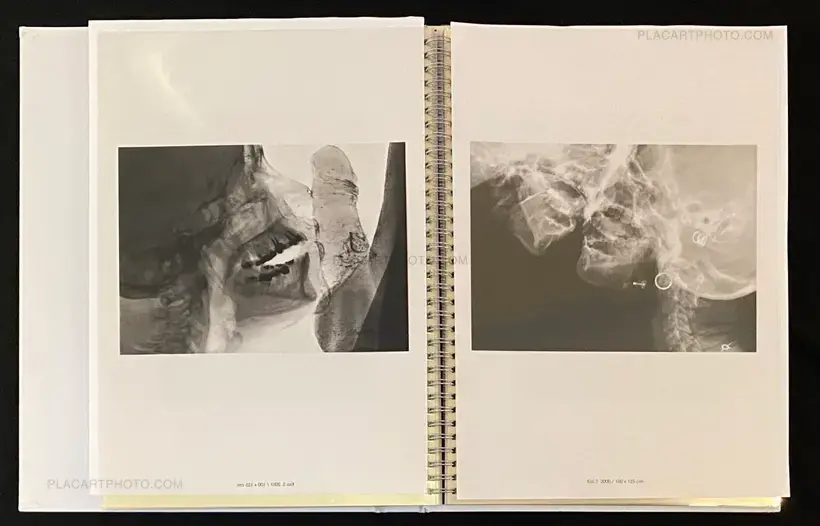 Wim Delvoye – seXrays
