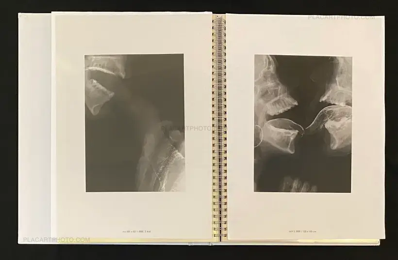 Wim Delvoye – seXrays