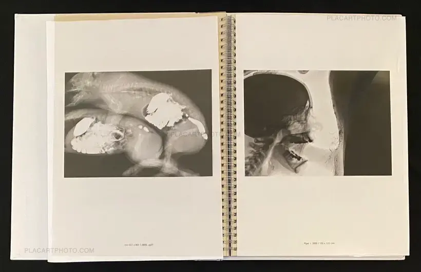 Wim Delvoye – seXrays