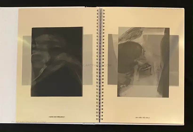 Wim Delvoye – seXrays