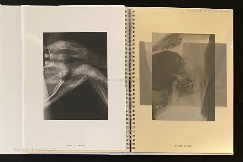 Wim Delvoye – seXrays