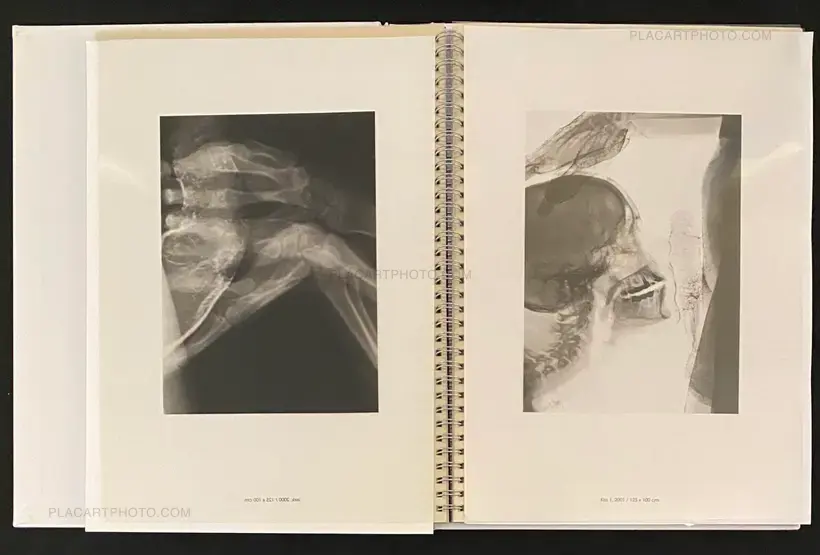 Wim Delvoye – seXrays