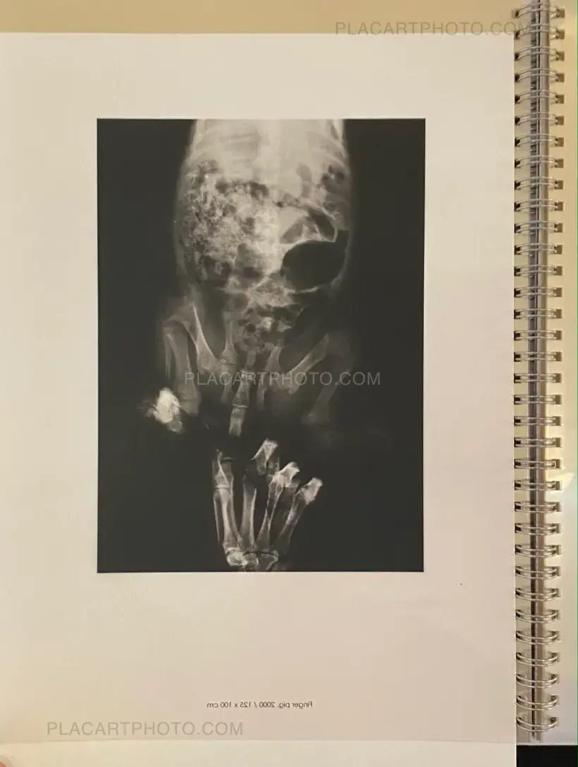 Wim Delvoye – seXrays
