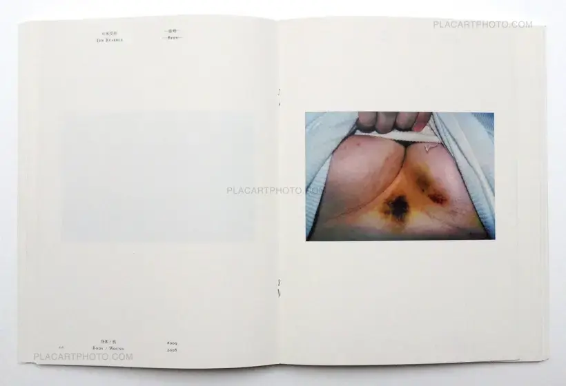 Chen Zhe – Bees & Bearable (Signed)