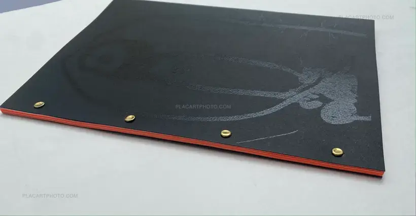 Thibault Tourmente – IMAGERIE PAR RESONANCE MAGNETIQUE