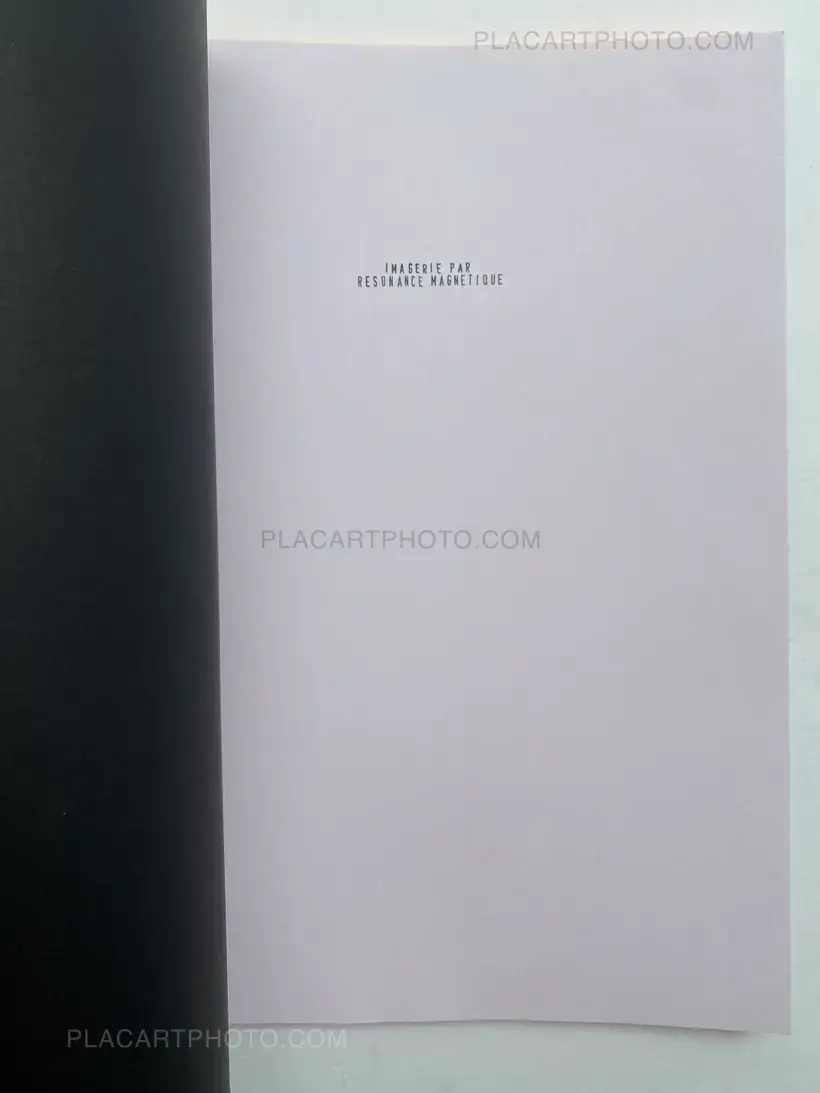 Thibault Tourmente – IMAGERIE PAR RESONANCE MAGNETIQUE