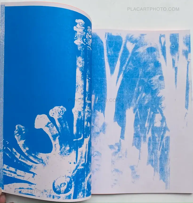 Thibault Tourmente – IMAGERIE PAR RESONANCE MAGNETIQUE