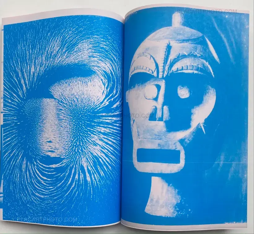 Thibault Tourmente – IMAGERIE PAR RESONANCE MAGNETIQUE
