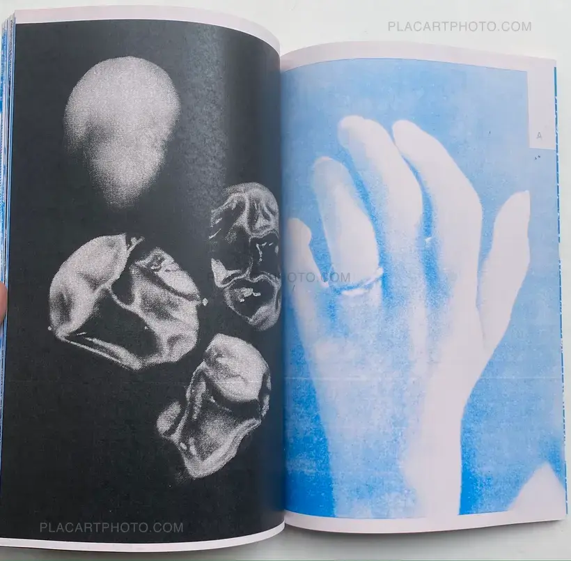 Thibault Tourmente – IMAGERIE PAR RESONANCE MAGNETIQUE