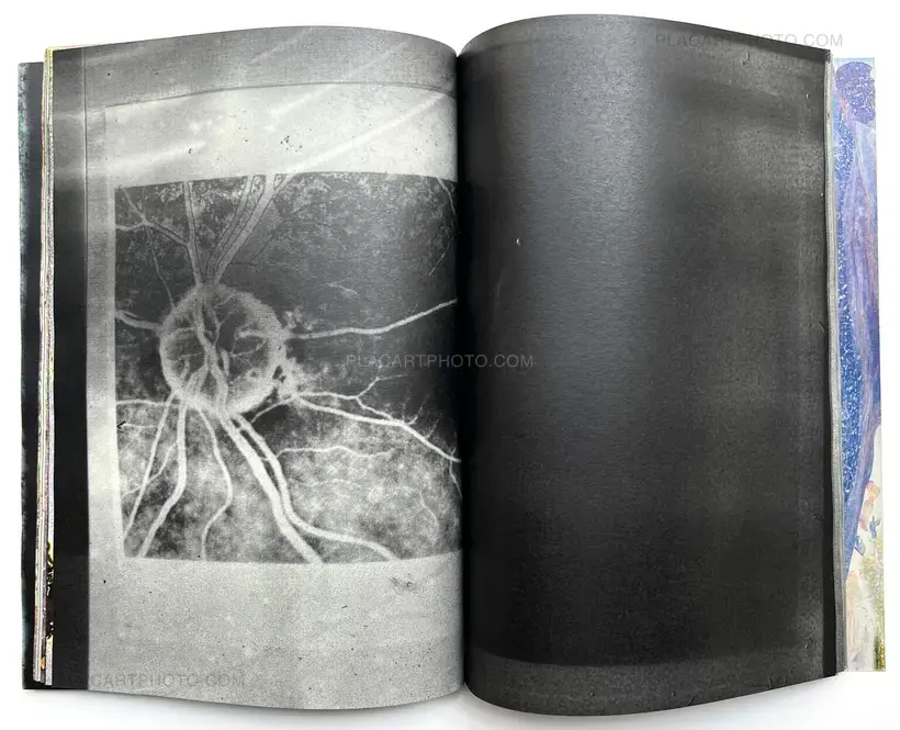 Daisuke Yokota – Matter (Cover A) (Signed, Unique edition)