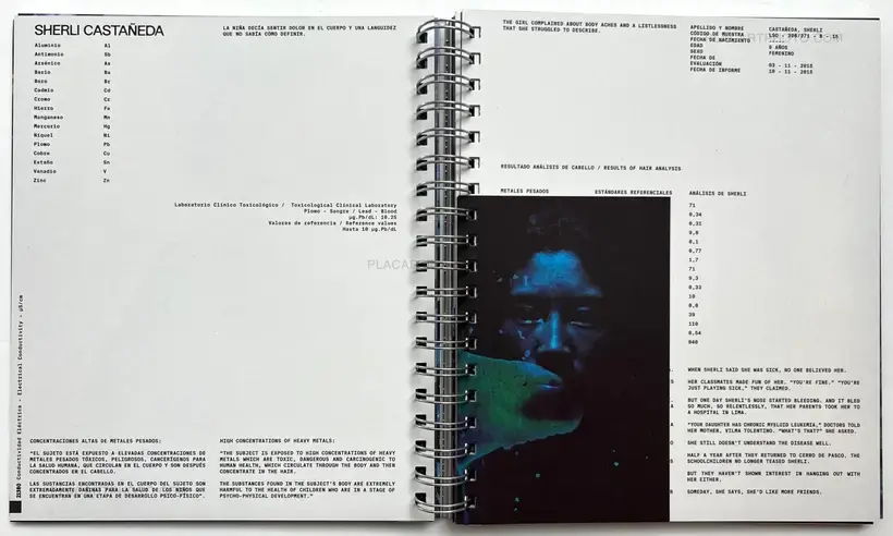 Marco Garro – Quiulacocha (With print)