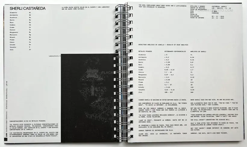 Marco Garro – Quiulacocha (With print)