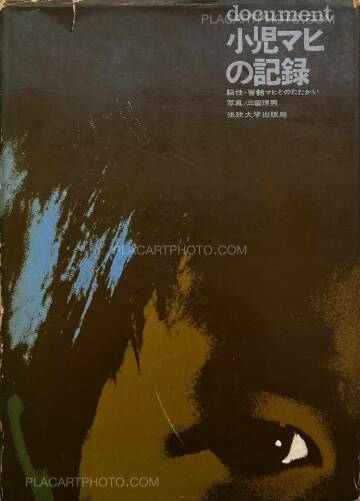 Tadao Mitome,Document : Shonimahi no kiroku / Document : Record of Infantile paralysis Tadao Mitome,Document : Shonimahi no kiroku / Document : Record of Infantile paralysis