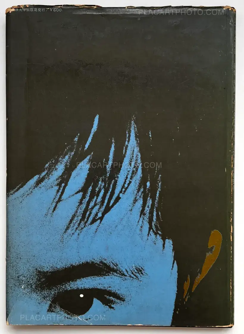 Tadao Mitome – Document : Shonimahi no kiroku / Document : Record of Infantile paralysis