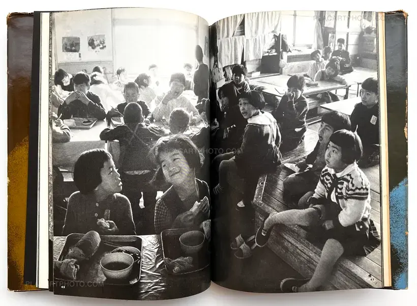 Tadao Mitome – Document : Shonimahi no kiroku / Document : Record of Infantile paralysis