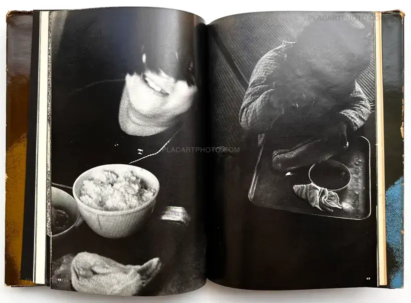 Tadao Mitome – Document : Shonimahi no kiroku / Document : Record of Infantile paralysis