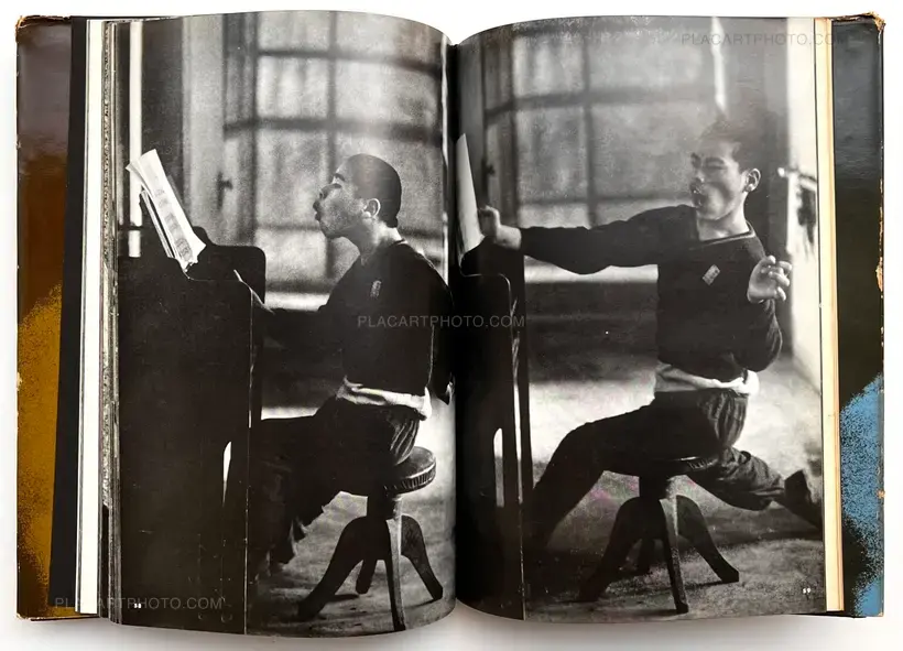 Tadao Mitome – Document : Shonimahi no kiroku / Document : Record of Infantile paralysis