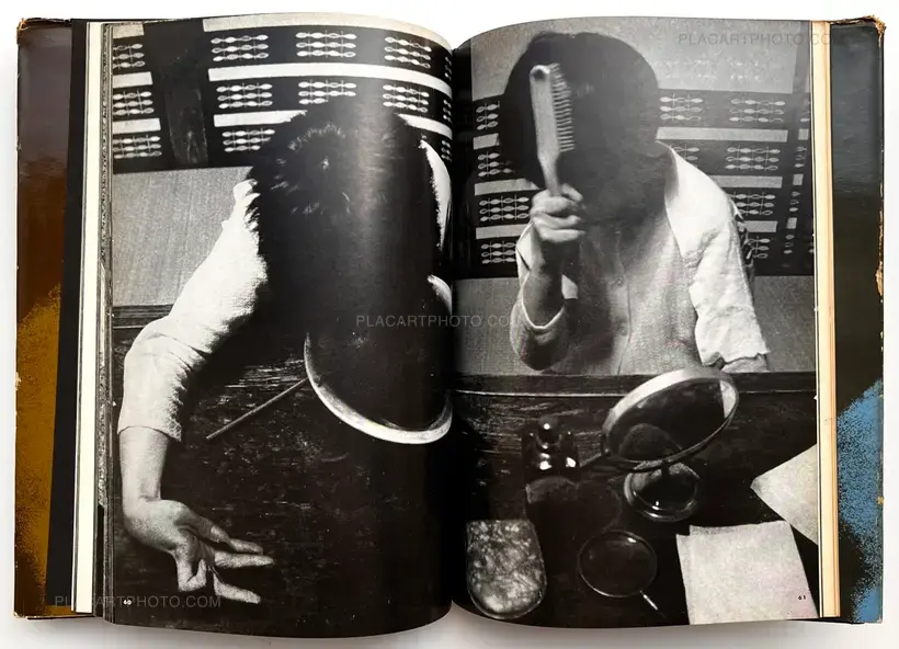 Tadao Mitome – Document : Shonimahi no kiroku / Document : Record of Infantile paralysis