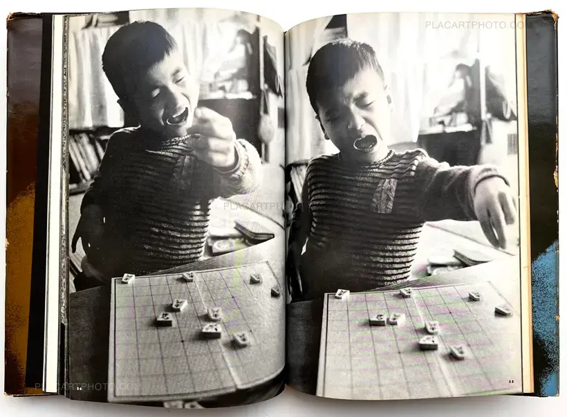 Tadao Mitome – Document : Shonimahi no kiroku / Document : Record of Infantile paralysis