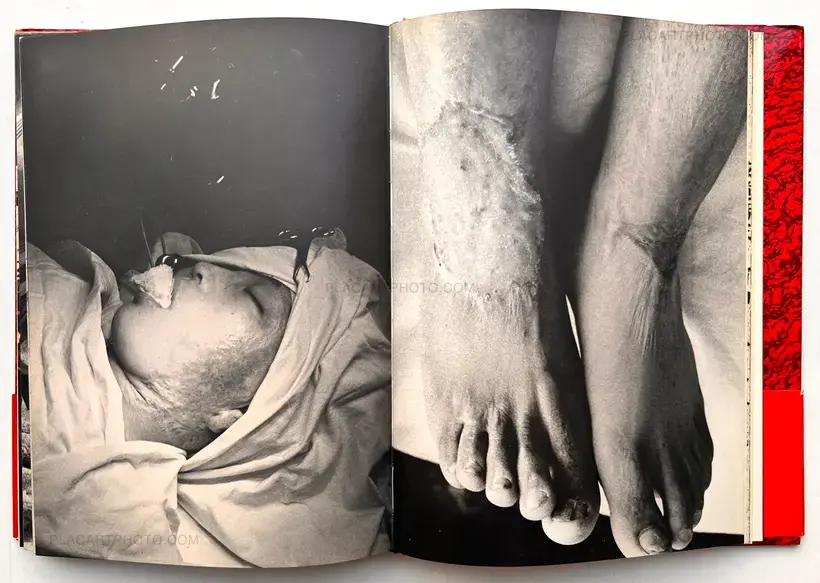 Ken Domon – Ikiteiru Hiroshima / Living Hiroshima